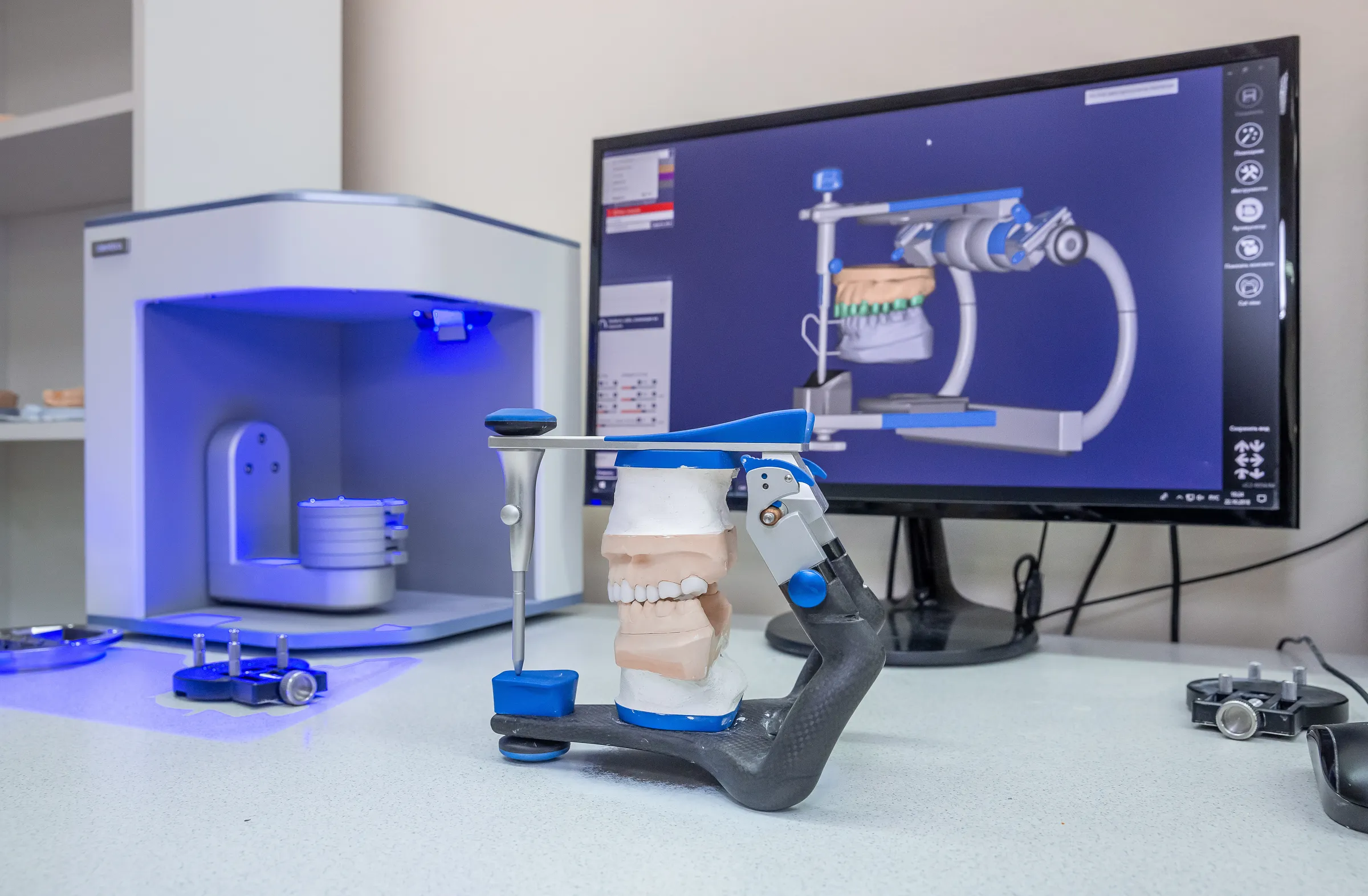 A digital scanner beside a monitor showing a 3D model of a patient's teeth
