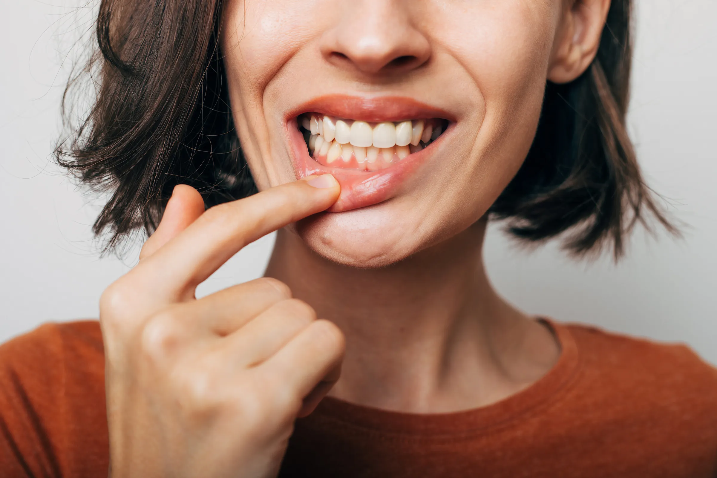 A woman lifting her lip to show her upper gum line